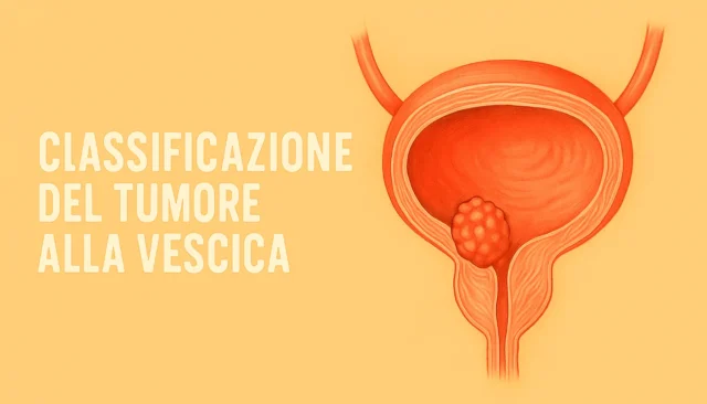 Classificazione del Tumore alla Vescica: Stadiazione e Grading